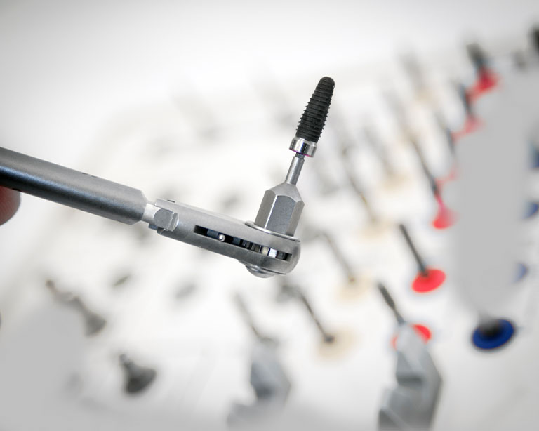 What are All-On-Four Dental Implants?