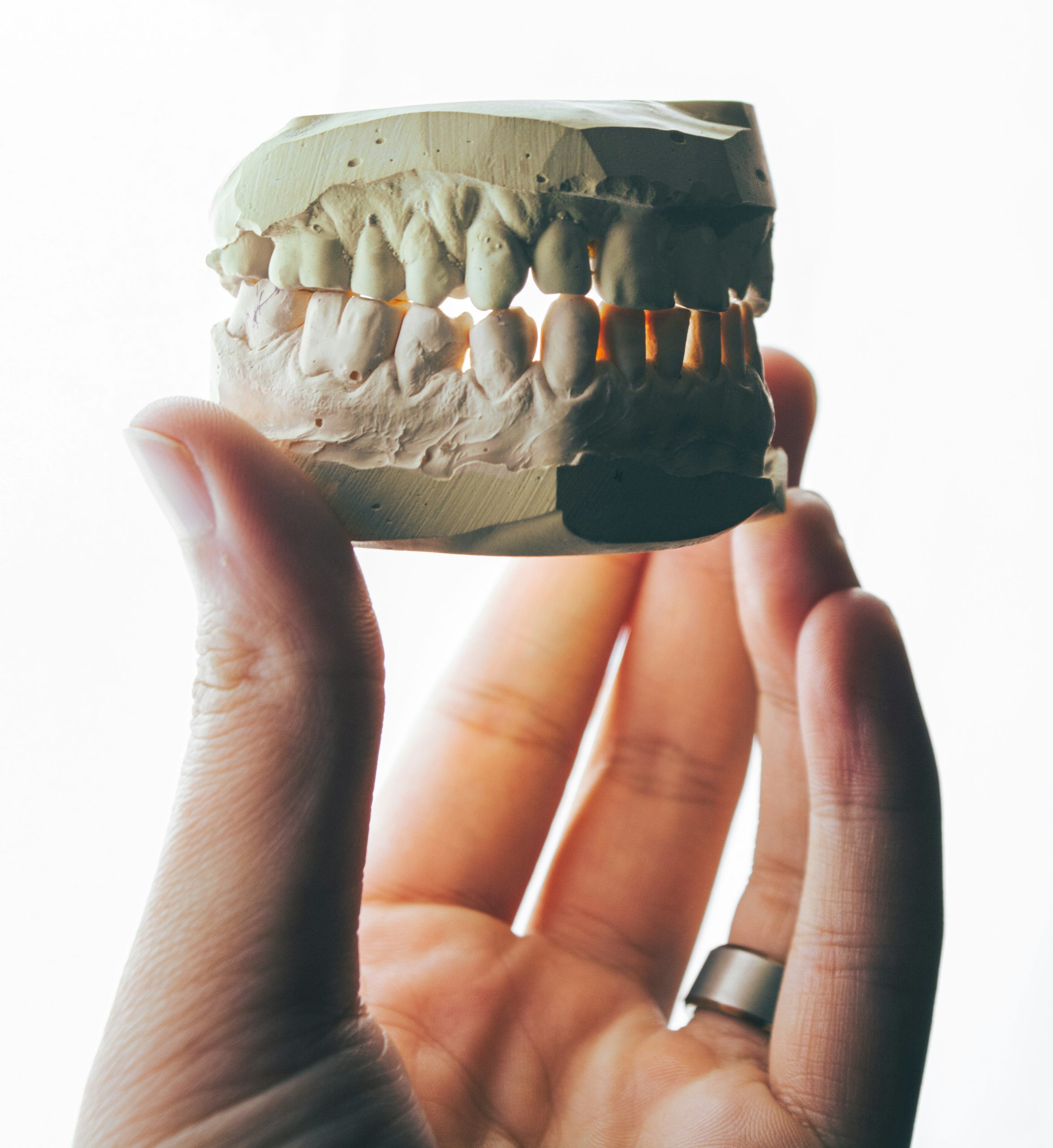 Dental Implants vs. General Dentistry: Understanding the Key Differences