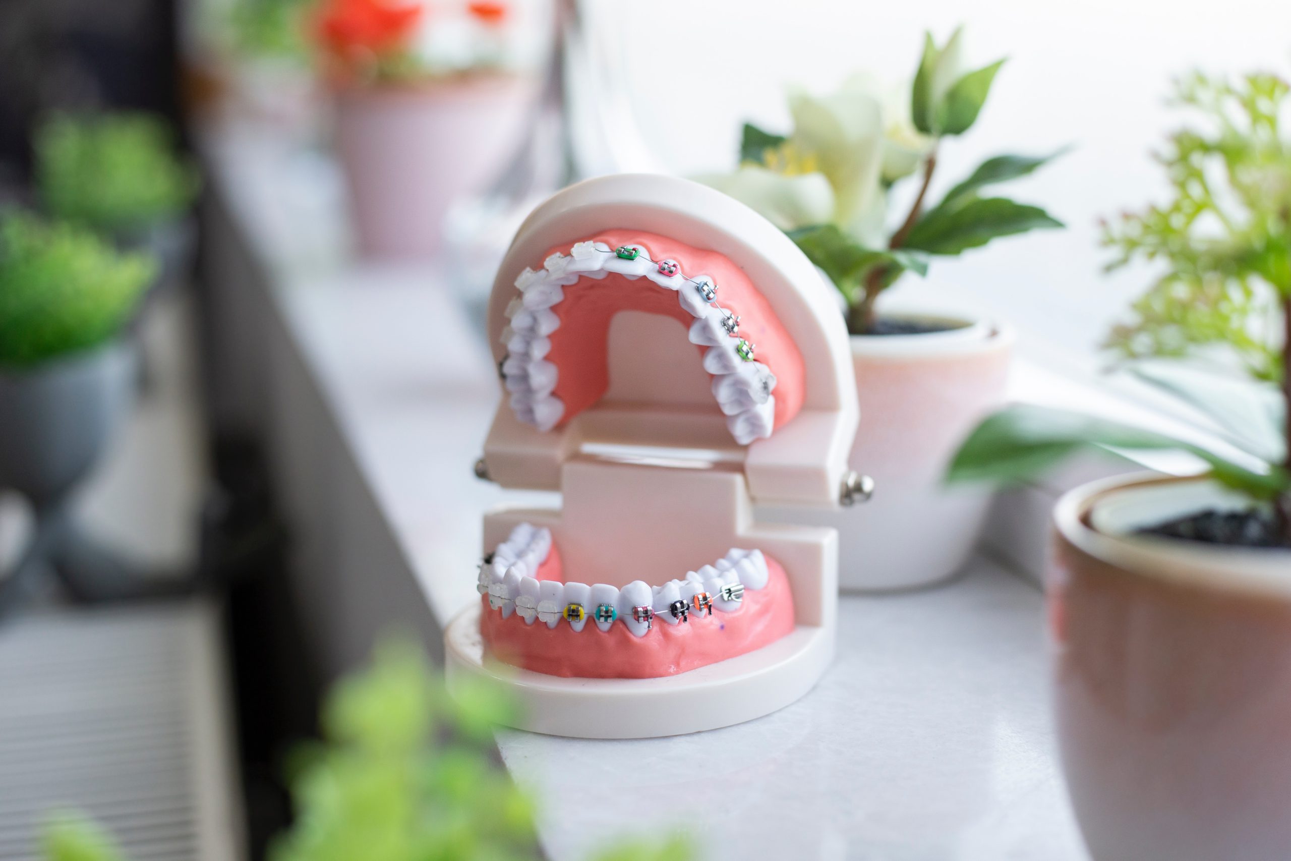 The Cost of Dental Implants