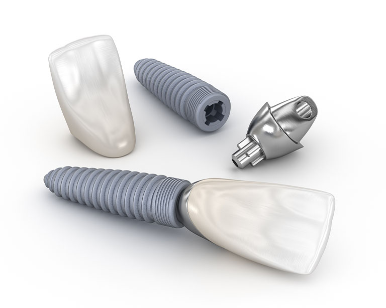 Dental implant parts