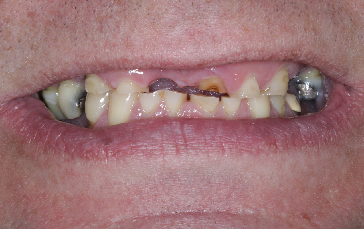Before